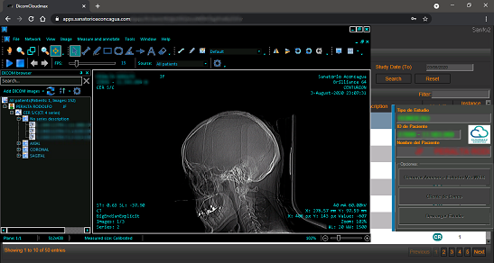 SkyDicom StudyGen — Previsualización