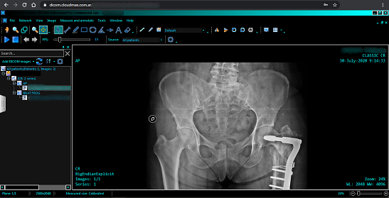 SkyDicom — Visualizador DICOM
